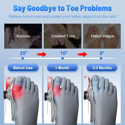 Nomidojo™ Bunion Corrector