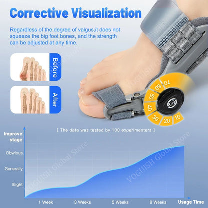Nomidojo™ Bunion Corrector