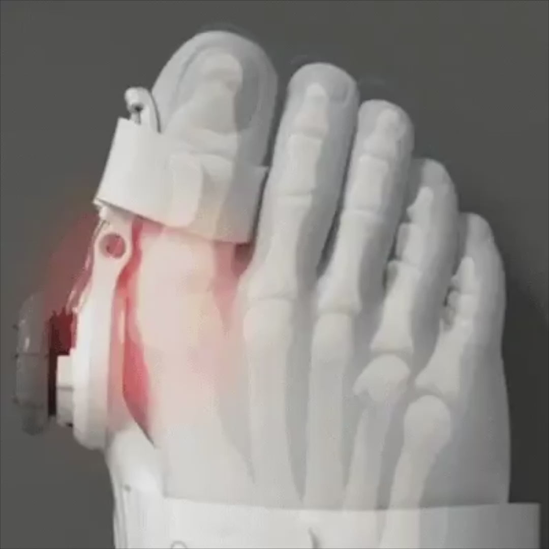 Load video: It's designed to support the realignment of the big toe and gradually alleviate inflammation by using a powerful patented hinge joint mechanism.It helps release muscular tension by simply pulling your bunion back to its natural position, resulting in pain-free natural realignment of your toe joint over time.